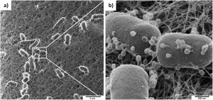 Scanning electron microscopy showing bacteriophages on the surface of bacteria