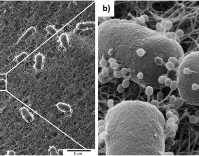 Scanning electron microscopy showing bacteriophages on the surface of bacteria
