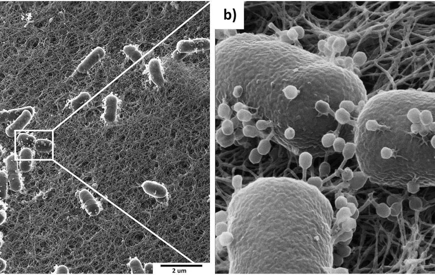 Scanning electron microscopy showing bacteriophages on the surface of bacteria