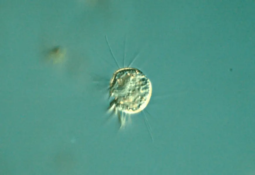 virovore Halteria the virus eating protist