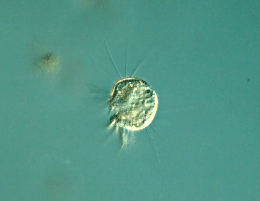 virovore-Halteria, the virus eating protist