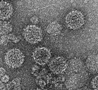 Micrograph of the mycovirus that infects white nose fungus on bats