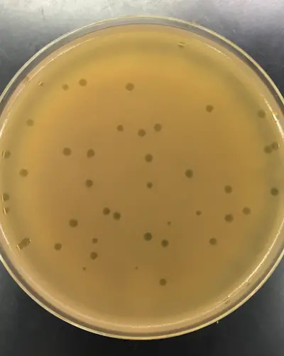 Phage plaques on plate