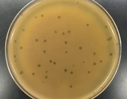 Phage plaques on plate