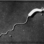 Electron microscopy image of Bdellovibrio bacteriovorus
