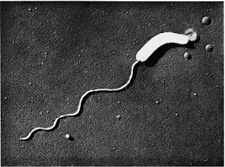 Electron microscopy image of Bdellovibrio bacteriovorus