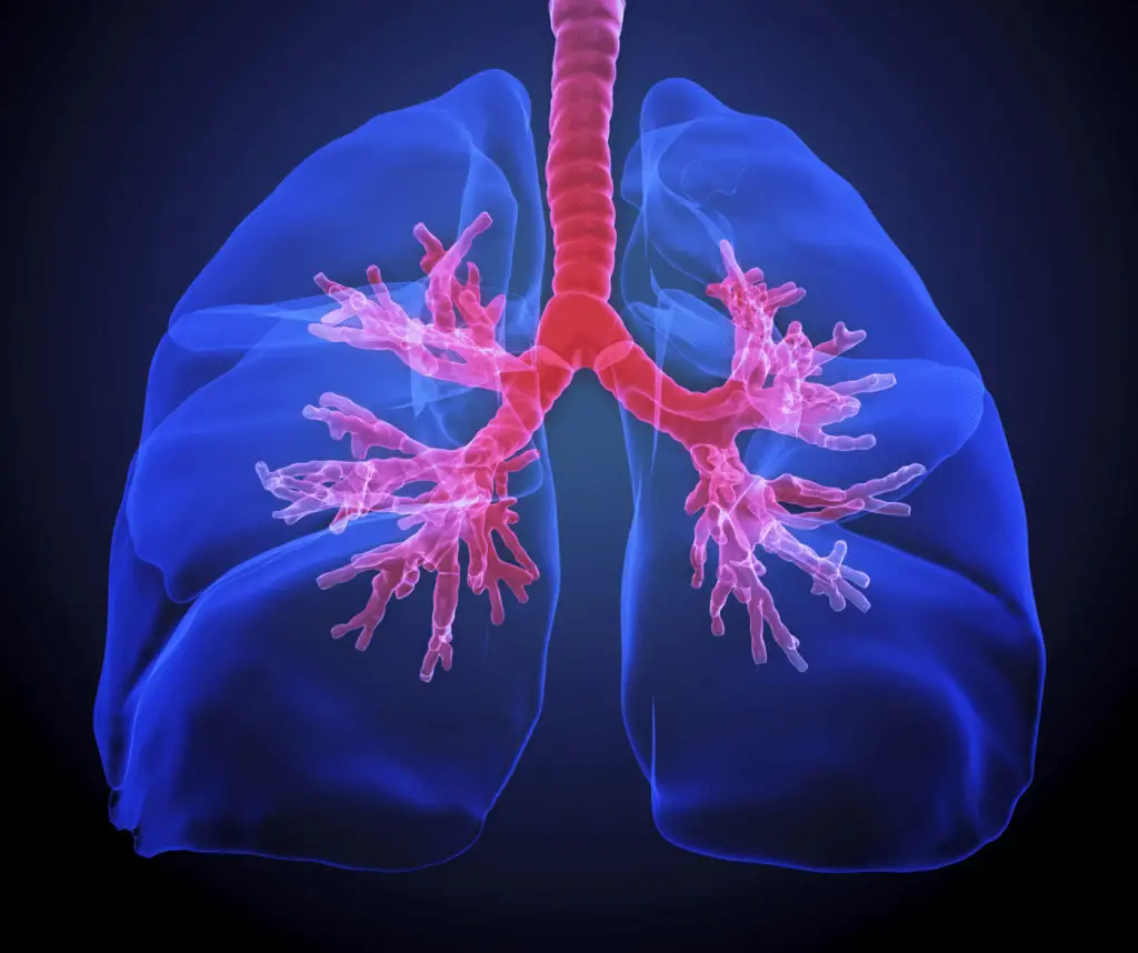 Lungs with cystic fibrosis