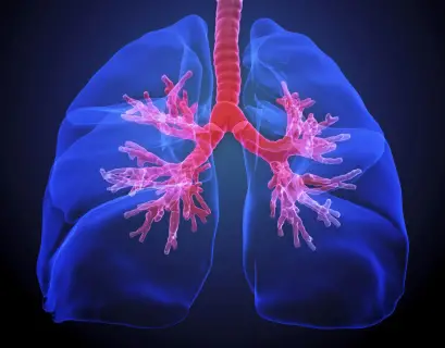 Lungs with cystic fibrosis