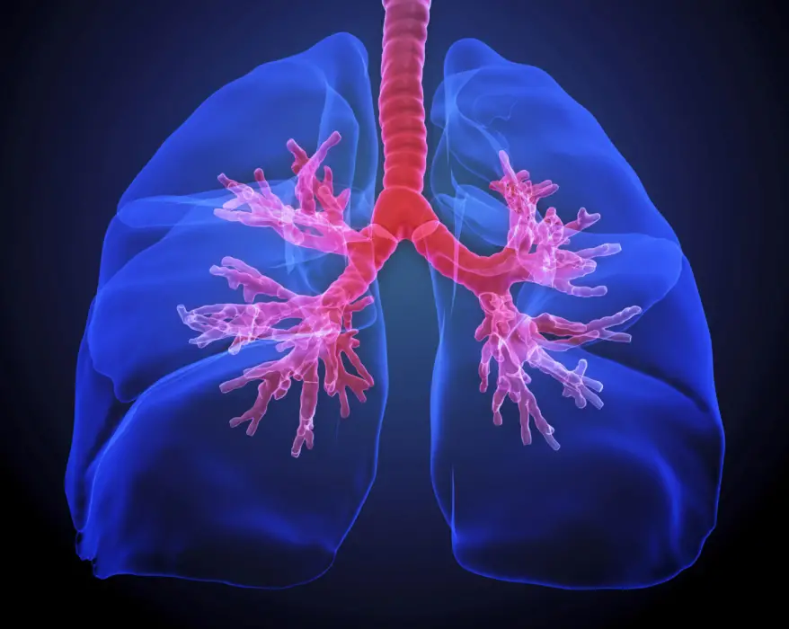 Lungs with cystic fibrosis