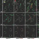 The growth and infection of M smegmatis cells with fluorescent phages were recorded in a CellASIC microfluidic device using time lapse imaging Both wild type and ∆lsr2 cells were observed