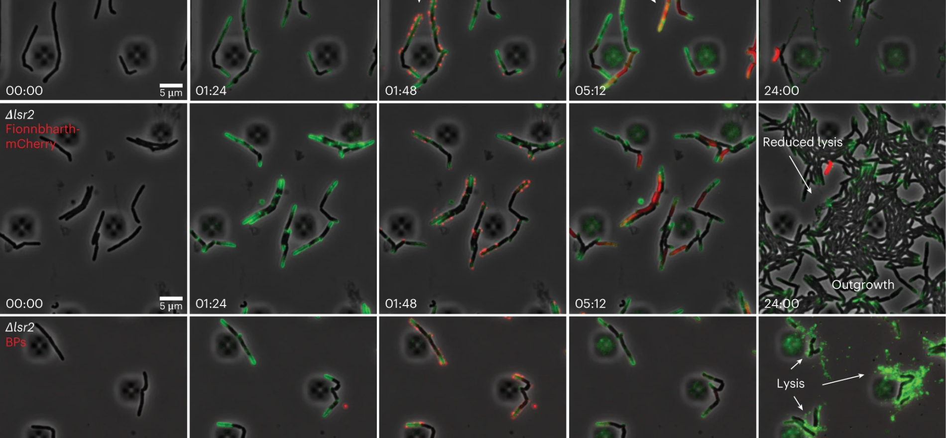 The growth and infection of M smegmatis cells with fluorescent phages were recorded in a CellASIC microfluidic device using time lapse imaging Both wild type and ∆lsr2 cells were observed