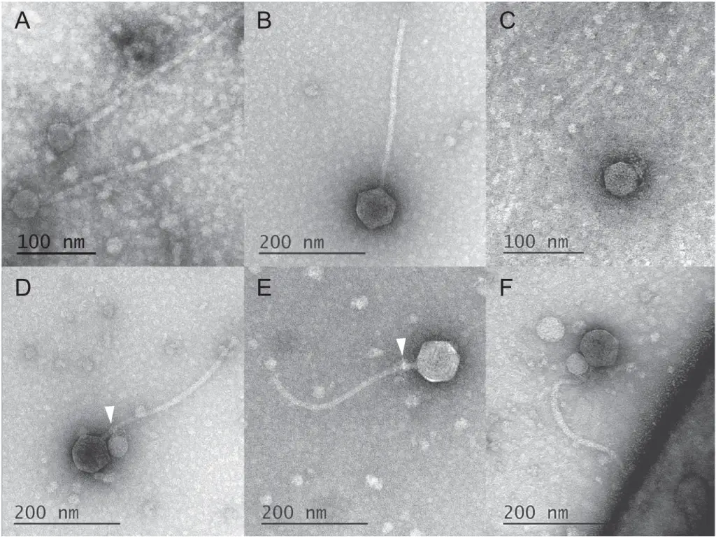 The original study's TEM images showcasing First-ever observation of a virus attaching to another virus