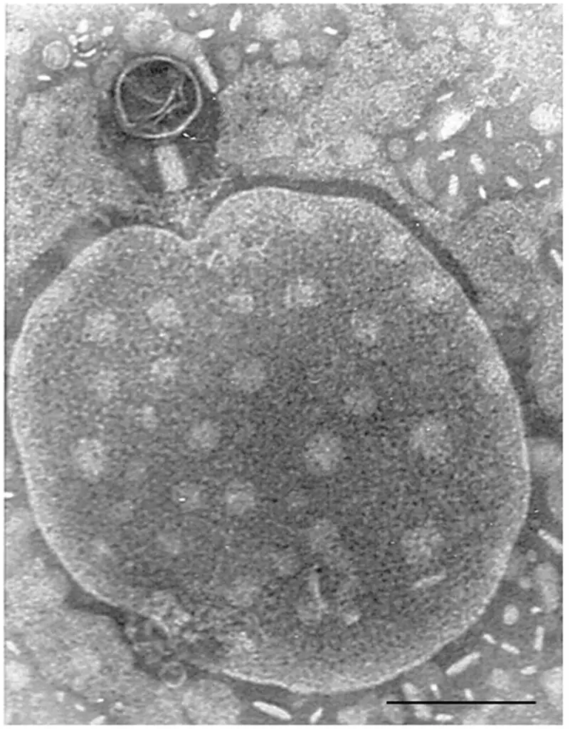 electron Microscopy of bacteriophage near the human cell