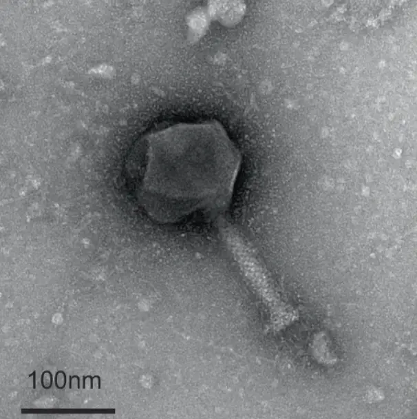 Negative stain TEM micrograph of phage Paride