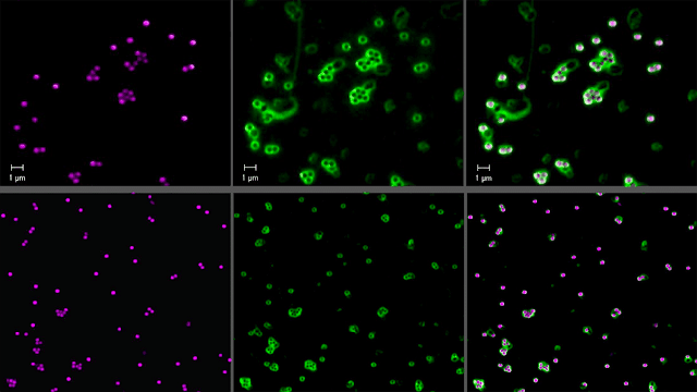 Purple and green microscopic imaging shows how particles coated in Dendripeps