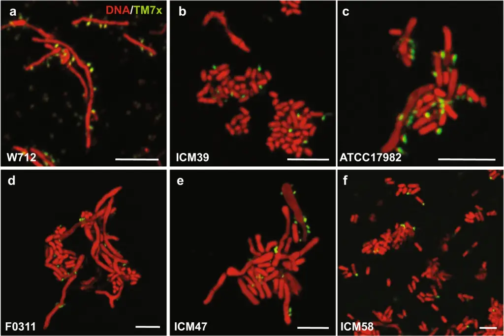 Photo of Nanosynbacter lyticus aka TM7x green and bacterial hosts red