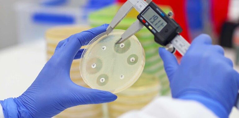 Phage susceptibility testing